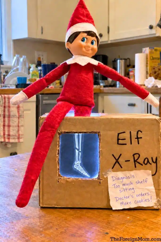 Funny Elf on the Shelf idea featuring an elf sitting on a homemade cardboard X-ray machine with a picture of leg bones and a silly diagnosis of too much shelf sitting.